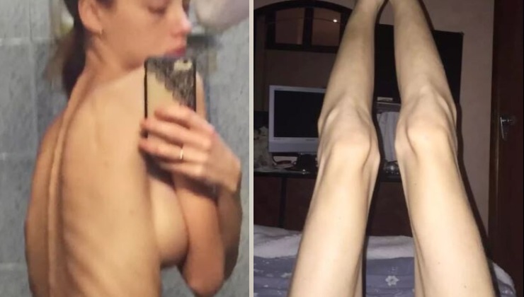 Rosalinda Cannavò mostra le foto di quando era anoressica | Fonte: INSTAGRAM